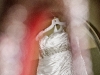 wedding-gown
